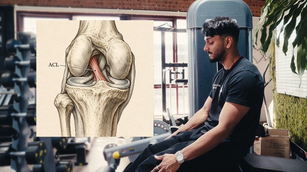 You’re Cleared After ACL Surgery — Why the First Thought Is “What If I Do It Again?”