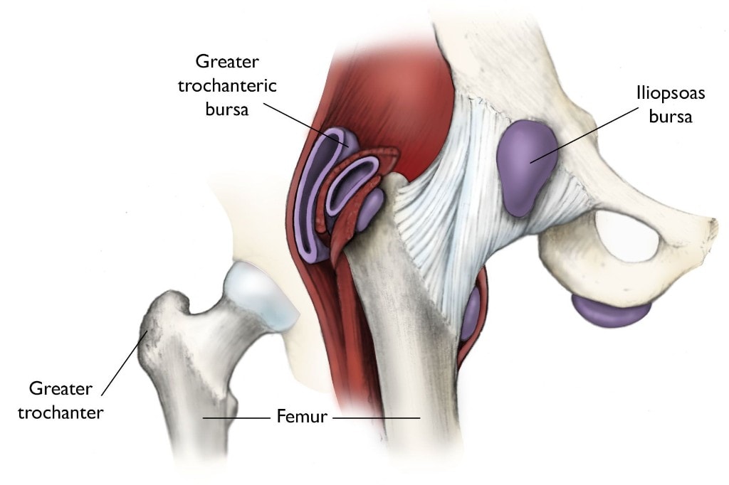 Hip Bursitis and Gluteal Tendinopathy: the Side-Of-Hip Pain We See Every Week in Cabramatta